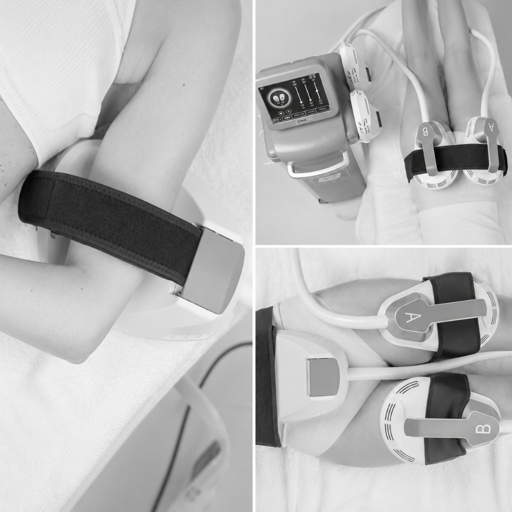 Equipo SCULPT para tratamiento muscular y suelo pélvico en Vitelia Clínica Integral